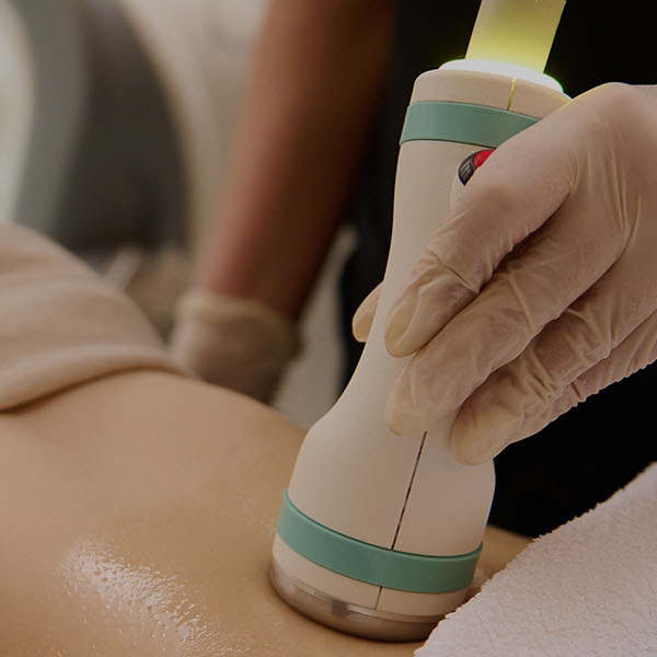 Laser Fat Loss
